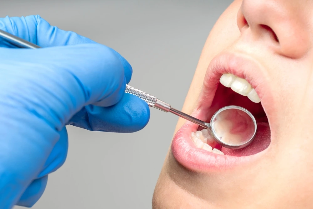 Close,Up,Of,Dentist,Hand,Examining,Patient,Teeth,With,Dental A dental mirror used during an examination