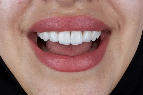 Close-up of a smiling mouth and teeth